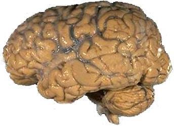 Human_brain_NIH